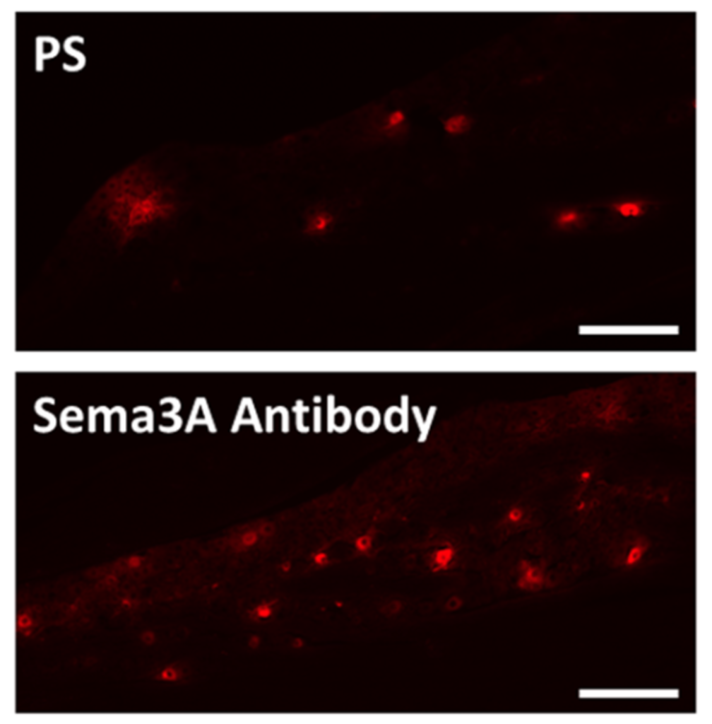 抗セマフォリン3A抗体を投与したマウスにおける神経細胞の比較1